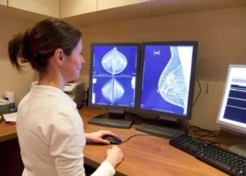 HRMC Enhances Mammography Services with Advanced Technology